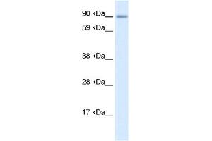 WB Suggested Anti-ZNF537 Antibody Titration:  0. (TSHZ3 Antikörper  (Middle Region))