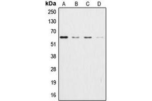 Western blot analysis of AKT expression in HeLa (A), HEK293T (B), NIH3T3 (C), H9C2 (D) whole cell lysates. (AKT1 Antikörper  (Center))