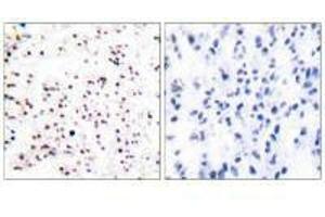Immunohistochemical analysis of paraffin-embedded human tonsil tissue using MCM5 antibody. (MCM5 Antikörper)
