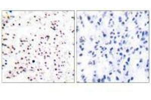 Immunohistochemical analysis of paraffin-embedded human tonsil tissue using MCM5 antibody. (MCM5 Antikörper)