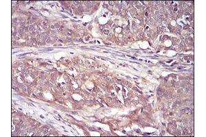 Immunohistochemistry (IHC) image for anti-Ribosomal Protein S6 Kinase, 90kDa, Polypeptide 2 (RPS6KA2) (AA 415-734) antibody (ABIN5542368)