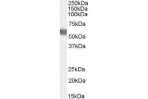 Image no. 1 for anti-Glucose-6-Phosphate Dehydrogenase (G6PD) (AA 308-320), (Internal Region) antibody (ABIN374790) (Glucose-6-Phosphate Dehydrogenase Antikörper  (Internal Region))