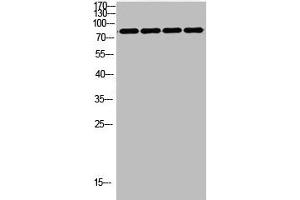 Western Blot analysis of customer's using FOXP1 Antibody Polyclonal Antibody. (FOXP1 Antikörper  (C-Term))