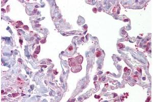 Anti-HPGDS / PGDS antibody IHC staining of human lung. (HPGDS Antikörper  (AA 35-84))