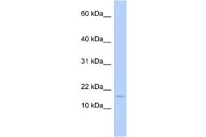 ISCA2 antibody used at 1 ug/ml to detect target protein. (ISCA2 Antikörper)