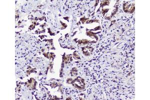 IHC analysis of TPR using anti-TPR antibody (ABIN5693275). (TPR Antikörper)