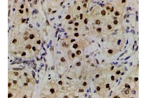 Immunohistochemistry (IHC) image for anti-LIM Domain Kinase 1 (LIMK1) (pThr508) antibody (ABIN6255701)