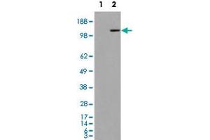 293 overexpressing MAN2A1 and probed with MAN2A1 polyclonal antibody  (mock transfection in first lane), tested by Origene. (alpha-Mannosidase II Antikörper  (Internal Region))