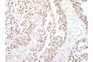 anti-Protein Phosphatase 4, Regulatory Subunit 2 (PPP4R2) (C-Term) antibody
