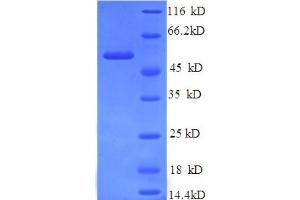 SDS-PAGE (SDS) image for Tyrosinase (TYR) (AA 19-377), (partial) protein (His tag) (ABIN5713924) (TYR Protein (AA 19-377, partial) (His tag))