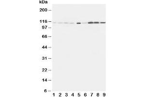 Western blot testing of EphA1 antibody and Lane 1:  rat liver;  2: (r) lung;  3: (r) intestine;  4: (r) ovary;  5: U87;  6: A549;  7: COLO320;  8: SW620;  9: HeLa cell lysate