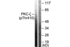 Western blot analysis of extracts from NIH-3T3 cells treated with PMA 125ng/ml 30', using PKC zeta (Phospho-Thr410) Antibody. (PKC zeta Antikörper  (pThr410))