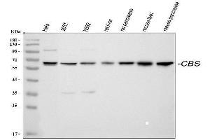 Western blot analysis of CBS using anti-CBS antibody (ABIN3043747). (CBS Antikörper  (AA 331-551))