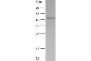 Western Blotting (WB) image for Cbl Proto-Oncogene B, E3 Ubiquitin Protein Ligase (CBLB) (AA 39-426) protein (His tag) (ABIN7122186) (Cbl Proto-Oncogene B, E3 Ubiquitin Protein Ligase (CBLB) (AA 39-426) protein (His tag))