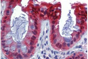 Human Colon (formalin-fixed, paraffin-embedded) stained with CASP7 antibody ABIN462357 followed by biotinylated anti-mouse IgG secondary antibody ABIN481714, alkaline phosphatase-streptavidin and chromogen. (Caspase 7 Antikörper)