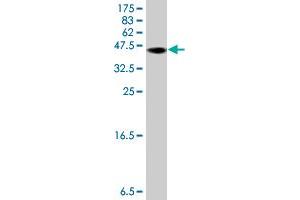 Western Blot detection against Immunogen (37. (CAPNL1 Antikörper  (AA 610-714))