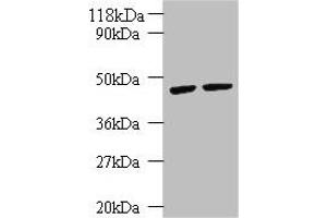 Western blot All lanes: KRT18 antibody at 2 μg/mL Lane 1: K562 whole cell lysate Lane 2: HepG2 whole cell lysate Secondary Goat polyclonal to rabbit IgG at 1/10000 dilution Predicted band size: 49 kDa Observed band size: 49 kDa (Cytokeratin 18 Antikörper  (AA 102-396))