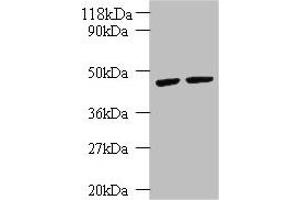 Western blot All lanes: KRT18 antibody at 2 μg/mL Lane 1: K562 whole cell lysate Lane 2: HepG2 whole cell lysate Secondary Goat polyclonal to rabbit IgG at 1/10000 dilution Predicted band size: 49 kDa Observed band size: 49 kDa (Cytokeratin 18 Antikörper  (AA 102-396))