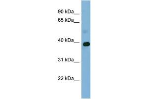 WB Suggested Anti-GAPDH Antibody Titration: 0. (GAPDH Antikörper  (Middle Region))