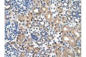 Image no. 1 for anti-Pre-B-Cell Leukemia Transcription Factor 3 (PBX3) (N-Term) antibody (ABIN203364) (PBX3 Antikörper  (N-Term))