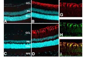 Localization of glutamine synthase in the retina.