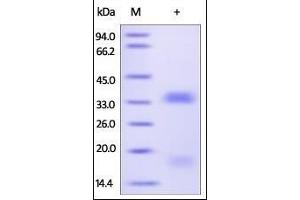 SDS-PAGE (SDS) image for Vascular Endothelial Growth Factor B (VEGFB) (AA 22-207) (Active) protein (His tag) (ABIN2181909) (VEGFB Protein (AA 22-207) (His tag))