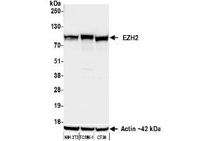 Western Blotting (WB) image for anti-Enhancer of Zeste Homolog 2 (EZH2) (AA 1-154) antibody (ABIN7795766) (Rekombinanter EZH2 Antikörper  (AA 1-154))