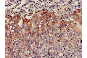 Immunohistochemistry of paraffin-embedded human adrenal gland tissue using ABIN7175304 at dilution of 1:100