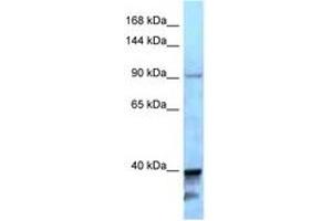 Image no. 1 for anti-Kinesin Family Member 7 (KIF7) (AA 1224-1273) antibody (ABIN6747946) (KIF7 Antikörper  (AA 1224-1273))