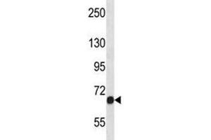 Fgfr1 antibody western blot analysis in NCI-H460 lysate. (FGFR1 Antikörper  (AA 756-784))