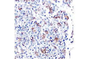Immunohistochemistry (IHC) image for anti-Fibroblast Growth Factor 21 (FGF21) antibody (ABIN1680154)