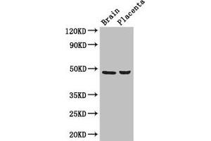 Western Blot Positive WB detected in: Mouse brain tissue, Human placenta tissue All lanes: CD177 antibody at 3 μg/mL Secondary Goat polyclonal to rabbit IgG at 1/50000 dilution Predicted band size: 47, 28, 16 kDa Observed band size: 47 kDa (CD177 Antikörper  (AA 22-321))