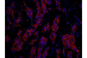 Immunofluorescence (IF) image for anti-Cytoskeleton-Associated Protein 4 (CKAP4) (AA 500-550) antibody (ABIN7448940) (CKAP4 Antikörper  (AA 500-550))