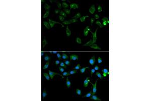 Immunofluorescence analysis of U2OS cells using TOLLIP antibody. (TOLLIP Antikörper  (AA 1-274))