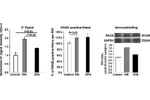 Western Blotting (WB) image for anti-Glyceraldehyde-3-Phosphate Dehydrogenase (GAPDH) antibody (ABIN2857072)