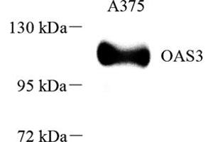 Western blot analysis of OAS3 (ABIN7072846),at dilution of 1: 1000 (OAS3 Antikörper)