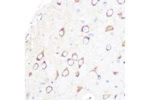 Immunohistochemistry of paraffin-embedded rat brain using MSR1 Rabbit mAb (ABIN7268353) at dilution of 1:100 (40x lens). (Macrophage Scavenger Receptor 1 Antikörper)