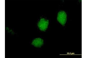 Immunofluorescence of purified MaxPab antibody to RARRES3 on HeLa cell.