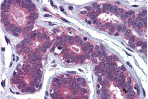 Immunohistochemistry (IHC) image for anti-Myosin VIIA and Rab Interacting Protein (MYRIP) (C-Term) antibody (ABIN185041)