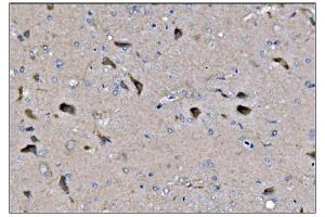 IHC analysis of Dynamin 3/DNM3 using anti-Dynamin 3/DNM3 antibody (ABIN7601163). (Dynamin 3 Antikörper  (AA 295-712))