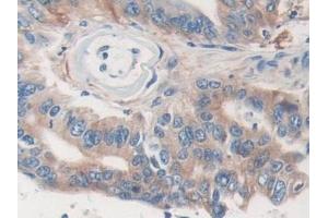 Immunohistochemistry (IHC) image for anti-Major Vault Protein (MVP) (AA 2-272) antibody (ABIN7441988)