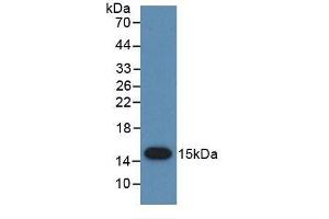 Detection of Recombinant PSCA, Human using Monoclonal Antibody to Prostate Stem Cell Antigen (PSCA) (PSCA Antikörper  (AA 22-95))