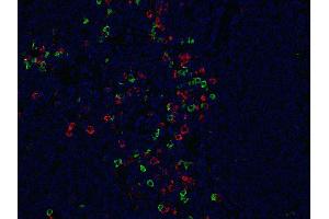 Indirect immunostaining of formalin-fixed paraffin embedded human tonsil section with anti-λ light chain (dilution 1 : 200; green) and mouse anti-κ light chain (cat. (Kaninchen anti-Human IgG lambda (Light Chain) Antikörper)