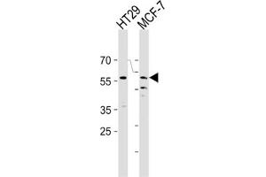 Western Blotting (WB) image for anti-Cell Division Cycle 7 (CDC7) antibody (ABIN3003260) (CDC7 Antikörper)