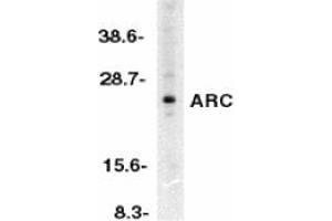 Image no. 1 for anti-Nucleolar Protein 3 (Apoptosis Repressor with CARD Domain) (NOL3) antibody (ABIN203569) (NOL3 Antikörper)