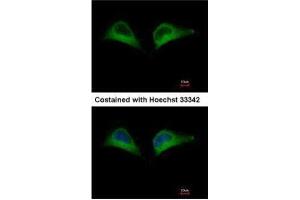 ICC/IF Image Immunofluorescence analysis of methanol-fixed HeLa, using PSMD7, antibody at 1:500 dilution. (PSMD7 Antikörper)