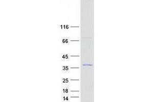 Western Blotting (WB) image for AlkB, Alkylation Repair Homolog 6 (ALKBH6) (Transcript Variant 2) protein (Myc-DYKDDDDK Tag) (ABIN2715941)