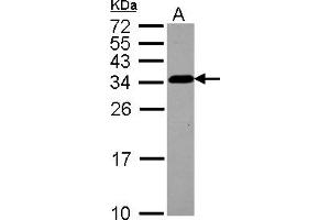 Western Blotting (WB) image for anti-Tubulin Folding Cofactor B (TBCB) (AA 1-219) antibody (ABIN1501321) (TBCB Antikörper  (AA 1-219))