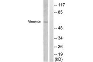 Western blot analysis of extracts from A549 cells, treated with Nocodazole 1ug/ml 16h, using Vimentin (Ab-56) Antibody. (Vimentin Antikörper  (AA 31-80))
