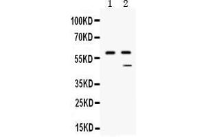 Western blot analysis of CPB2 expression in human placenta extract ( Lane 1) and HEPG2 whole cell lysates ( Lane 2). (CPB2 Antikörper  (AA 166-388))